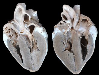 06-2b-ox-heart.jpg