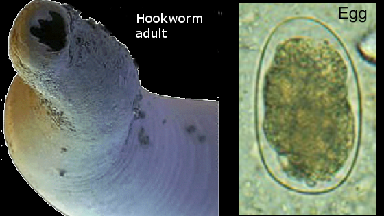 Hookworm adult and egg