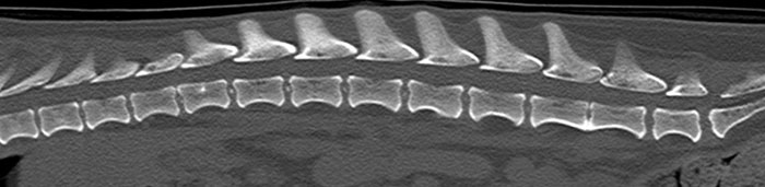 Disc herniation