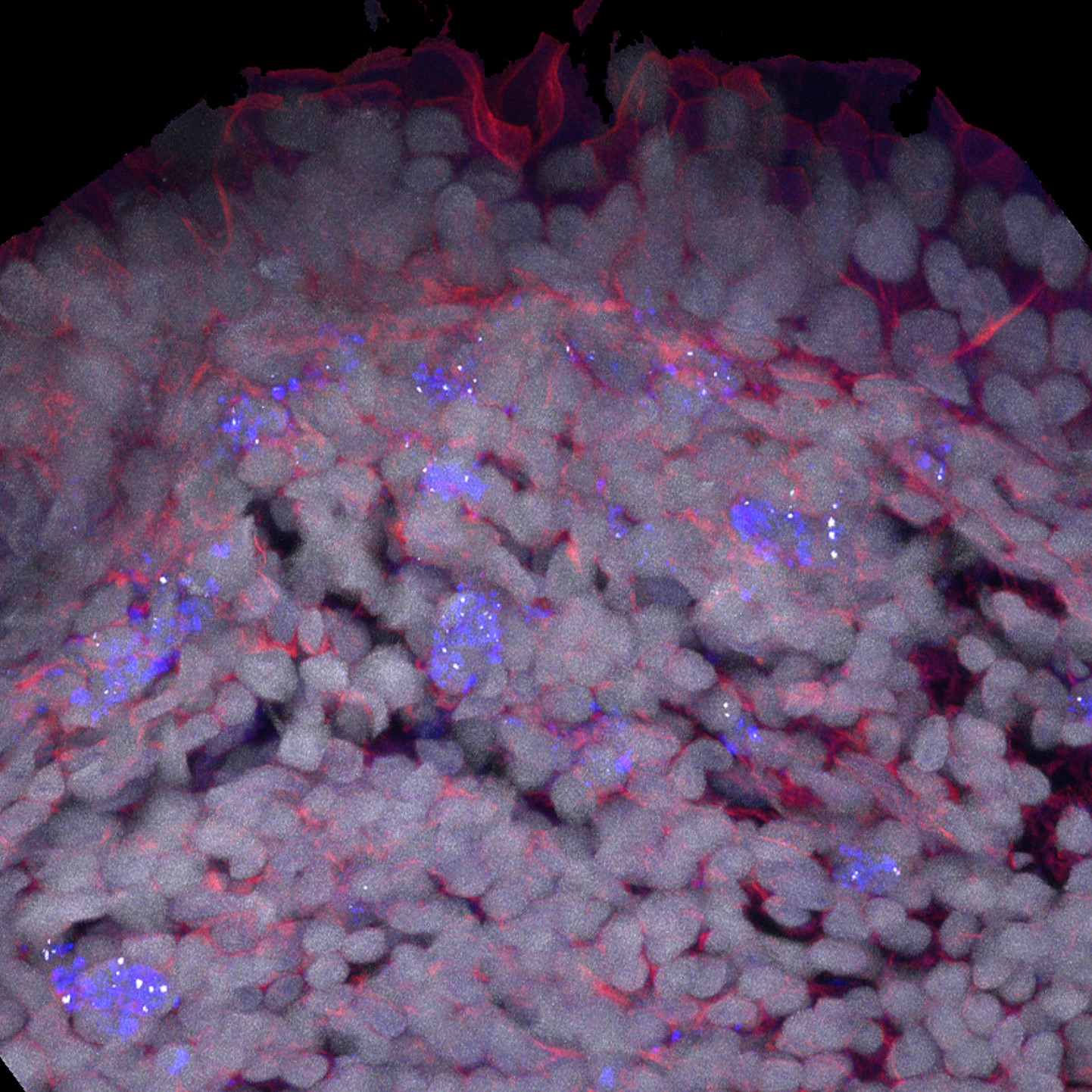 Photo shows fgTiO2 specifically targeting autofluorescent, antigen-presenting cells of the Peyer's patch. 