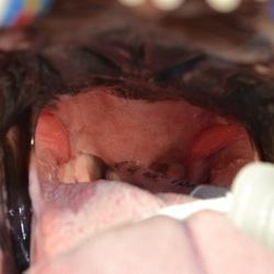 Dog Surgery Spotlight: Treating an Elongated Soft Palate in