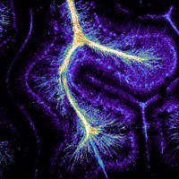 an image of the brain's superhighway