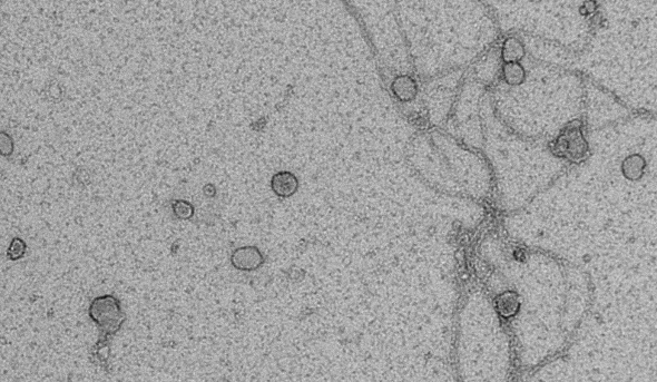 EM of Urinary Exosomes