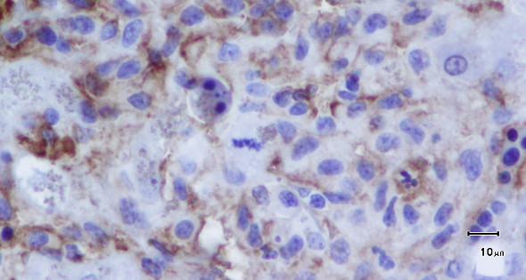 Flat-coated retriever, Histiocytic sarcoma