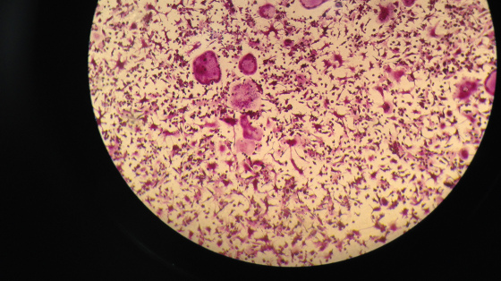 Micrograph of mouse osteoclasts, isolated from bone marrow and cultured on a calcium phosphate bone substitute. In-vitro models like this allow for both fundamental studies on bone biology and experimental studies on new therapeutic agents.